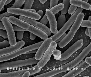 makiandampars - E-coli