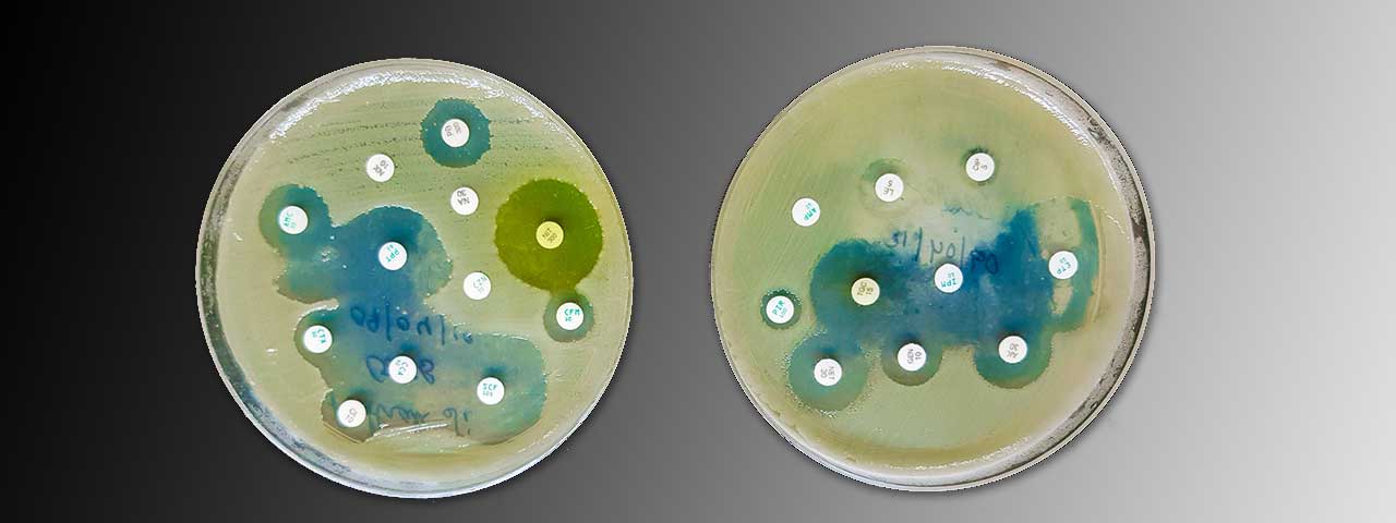 makiandampars - antimicrobial resistance