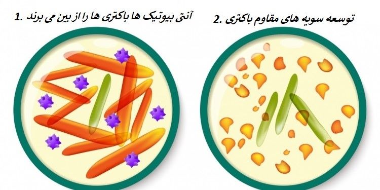 مقاومت آنتی بیوتیکی؛ علل، پیشگیری و راه درمان عفونت های مقاوم