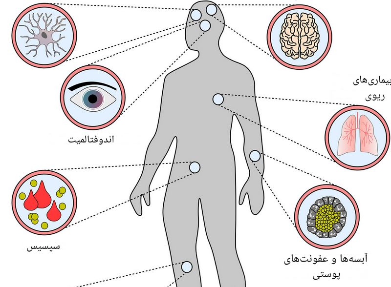 مقاومت آنتی بیوتیکی در باکتری استافیلوکوکوس اورئوس