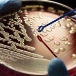 مقاومت ضد میکروبی (AMR)؛ اثر متابولیسم باکتری ها در مقاومت