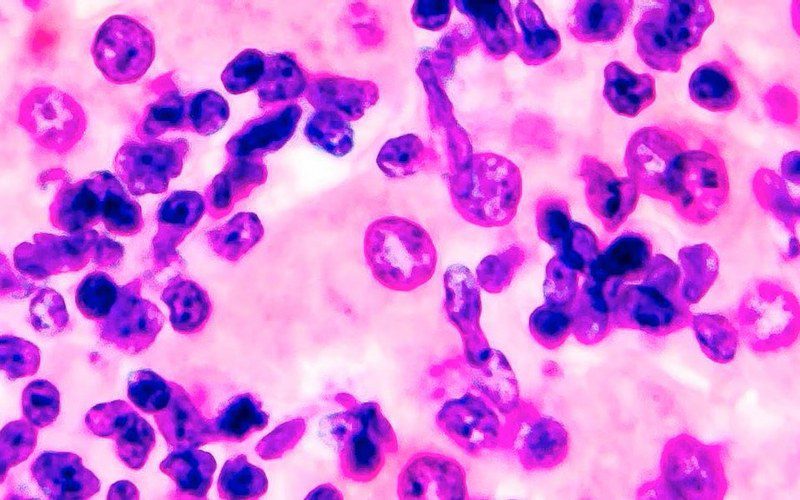 مرور کلی بر کوکسیدیوز در بوقلمون و ضد کوکسیدیوز موثر