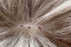 علت و درمان ریزش مو خرگوش