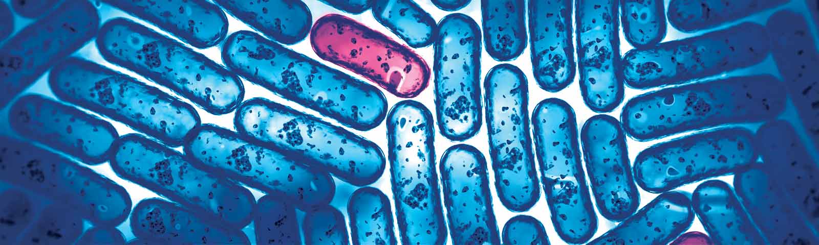 مقاومت ضدمیکروبی (AMR): روش های آزمایشگاهی تشخیص مقاومت آنتی بیوتیکی