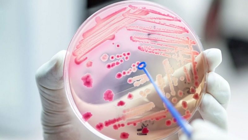 مقاومت ضدمیکروبی (AMR); هدف از پایش مقاومت ضد میکروبی و مبانی قانونی آن در اروپا