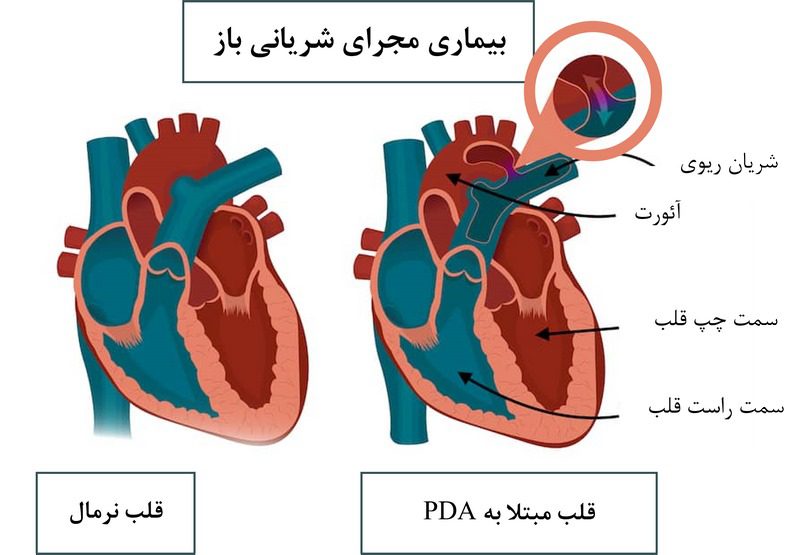 انواع بیماری قلبی سگ