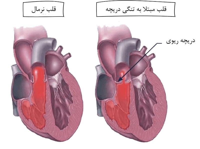 انواع بیماری قلبی سگ