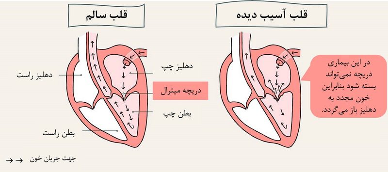انواع بیماری قلبی سگ