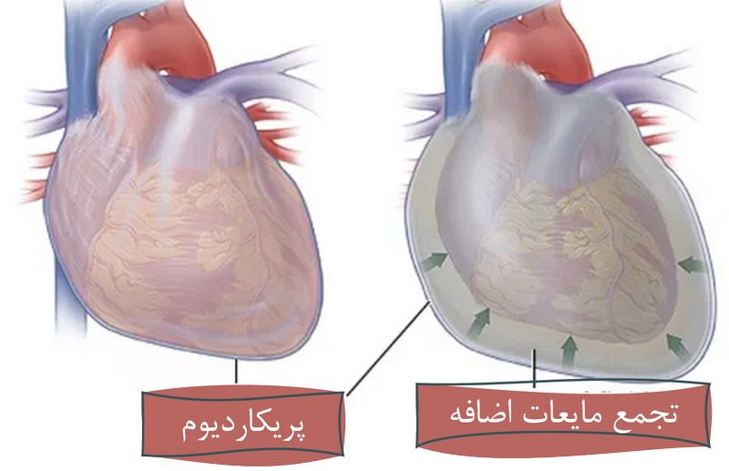 انواع بیماری قلبی سگ